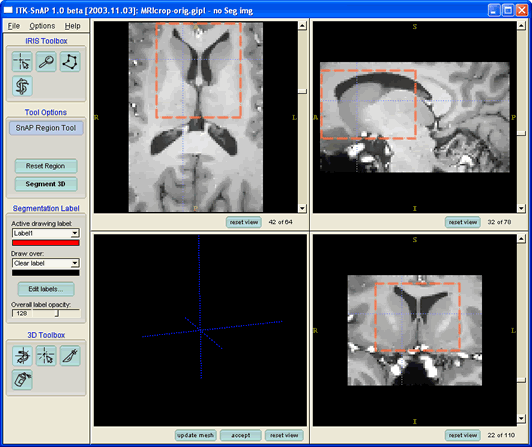 Selecting the Right Snap Installation Tool